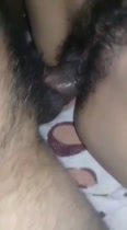 Slip de piel con mucho cabello en un TTO