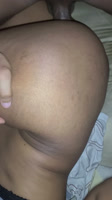 Ninguno de la piel